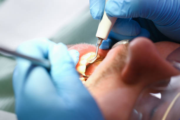 Best Emergency Treatment for Dental Infections or Abscesses in Shenandoah Junction, WV