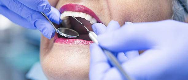 Best Urgent Care for Lost Fillings or Crowns in Shenandoah Junction, WV